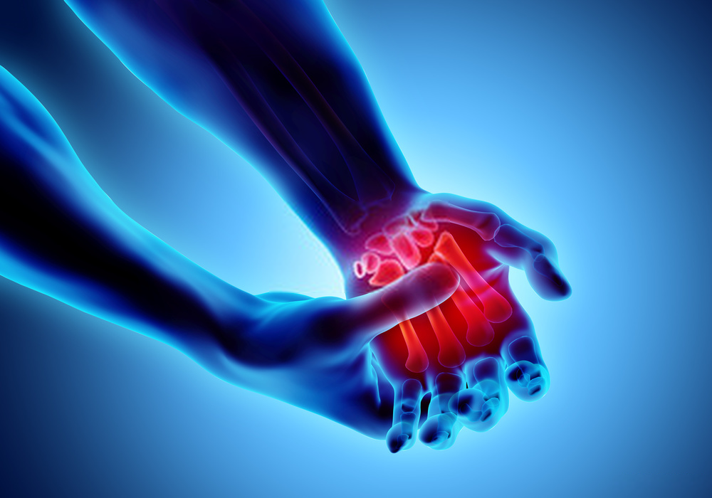 What Are The Causes Of Arthritis And How Can It Be Cured Naturally