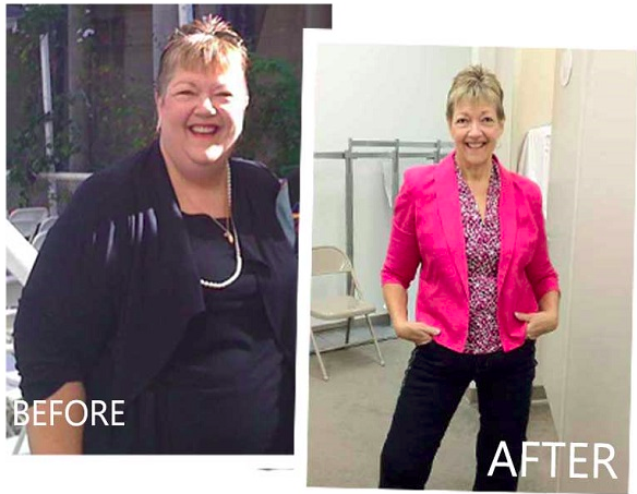  Slim Over 55 Before After